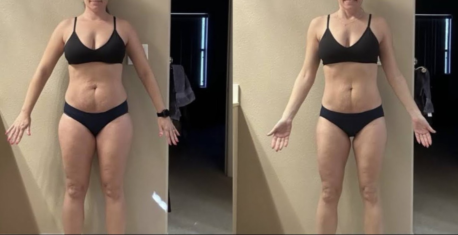 Kimberly H.: Flex Appeal client before and after