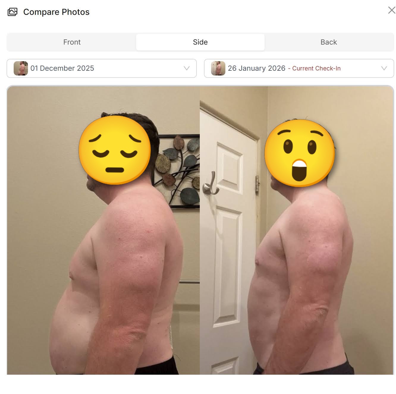 Michael G.: Flex Appeal client before and after